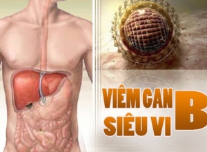 Viêm gan siêu vi B có nguy hiểm không?